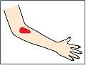 Klicke auf die Grafik für eine vergrößerte Ansicht

Name: arm.jpg
Ansichten: 42
Größe: 48,9 KB
ID: 690401